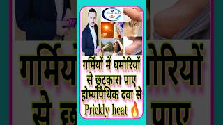 घमोरी Ghamori summer गर्मी Pricklyheat heatrash shorts youtubeshorts homeopathy short [upl. by Lavona]