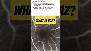 What is foveal vascular zone FAZ in retina retina opthalmology [upl. by Eadahs285]