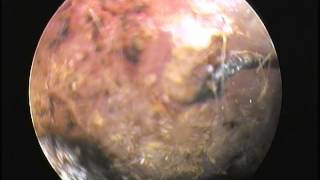 DES MOINES VETERINARY CARE VIDEO  Ear Mites Viewed with Video Otoscope at Ingersoll Animal Hospital [upl. by Emawk445]