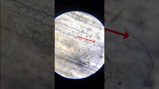 NAILS 🤢🤮 Under Microscope shorts microscope science [upl. by Wayland]