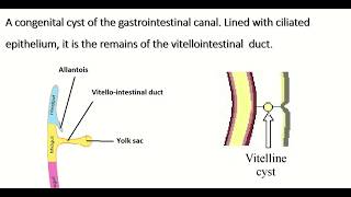 Embryology of vitellointestinal duct  formation fate amp congenital anomalies [upl. by Esinet]