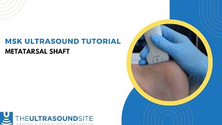 Musculoskeletal ultrasound evaluation of the metatarsal shaft [upl. by Nauaj]