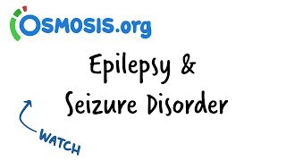 Epilepsy amp Seizure Disorder  Clinical Presentation [upl. by Centeno]