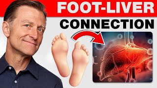 How Your Feet Are Warning You About Your Liver Problems  Dr Berg Explains [upl. by Zat969]