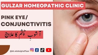 Pink Eye conjunctivitis  Eye Flu quotlGulzar Homeopathic Clinic  Natural Healing quot eyeflu kmkt [upl. by Dulcinea]