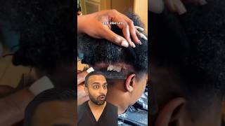 The Importance Of Treating Scalp Psoriasis  Dr Somji Explains [upl. by Teplica524]