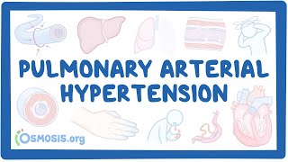 NORD  Pulmonary Arterial Hypertension [upl. by Richards]