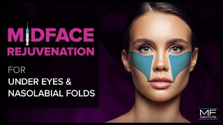 Under Eye and Midface Rejuvenation with Dermal Fillers at Mabrie Facial Institute [upl. by Eniretak]