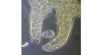 nutrition in amoeba  real under microscopic view  digestion absorption  excretion [upl. by Nassah]