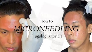 How to Microneedle Tagalog using New Skin New Me  Acne Scar Repair Kit by TCC [upl. by Alaine924]