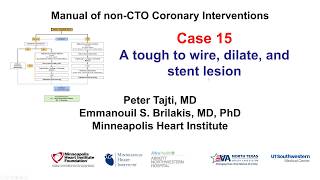 Case 15 PCI Manual  Balloon undilatable [upl. by Mile]