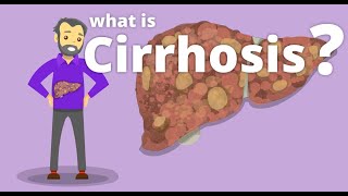 Cirrhosis  What is cirrhosis [upl. by Asp]