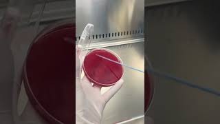 Pus Culture Identifying Infections for Better Treatment  Lab Testing Explained lab shortvideo [upl. by Aremmat]