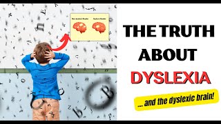 Dyslexia amp The Dyslexic Brain EXPLAINED Reading In the Brain BOOK Main INSIGHTS Stanislas Dehaene [upl. by Acimat146]