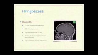 Basiskurs Neurologie Entzündliche Erkrankungen Teil 814 [upl. by Poler760]