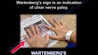 Wartenbergs Sign  Everything You Need To Know  Dr Nabil Ebraheim [upl. by Ahsatal]