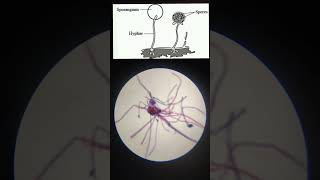 Rhizopus slide under MicroscopeMicroorganism [upl. by Amathist198]