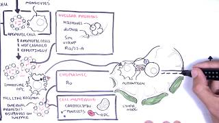 Systemic Lupus Erythematosus SLE  signs and symptoms pathophysiology investigations treatment [upl. by Ylen]