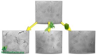 AntiAngiogenesis Cutting Off Tumor Supply Lines [upl. by Farrica802]