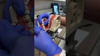 Removal of orthodontic separators [upl. by Nnaihs]