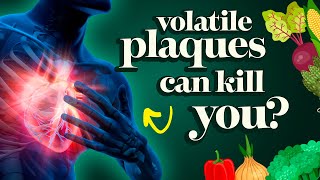 Dr McDougall Explains Heart Diseases And The Hidden Danger of Ruptured Volatile Plaque [upl. by Macswan106]