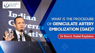 What is the Procedure of Geniculate Artery Embolization GAE  Dr Ravul Jindal Explains [upl. by Kcirddet]