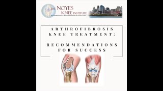 Arthrofibrosis Testimonial Ft Lauderdale [upl. by Parthen]