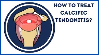 How to treat calcific tendonitis [upl. by Silberman206]