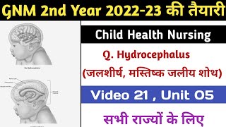 Hydrocephalus मस्तिष्क जलीय शोथ  Video 21 Unit 05 Child Health Nursing सभी के लिए 202223 [upl. by Ekard]