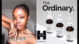 The Ordinary  Skincare Routine for Oily Skin How to Get Rid of Hyperpigmentation  Treat Pimples [upl. by Izogn]