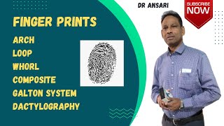 Finger prints  Galton system  Arch  Loop  Whorl  Dactylography  Composit  Compound [upl. by Joanna368]