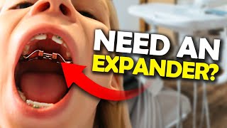 Getting a Palatal Expander What you NEED to know  McKinney Orthodontist [upl. by Ruddie]