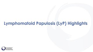 Diagnosis Lymphomatoid Papulosis [upl. by Tad]