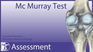 McMurray Test  Meniscus Damage update in description [upl. by Atiram]