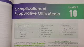 Complications of Suppurative Otitis Media  ENT [upl. by Anilosi]