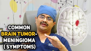 Common Brain Tumor Meningioma  Symptoms DrRoopesh Kumar [upl. by Jori]