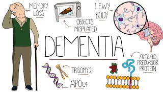 Understanding Dementia Alzheimers amp Vascular amp Frontotemporal amp Lewy Body Dementia [upl. by Oigroeg]