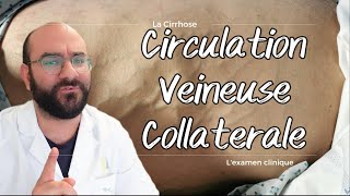 La Circulation Veineuse Collatérale [upl. by Cassella314]