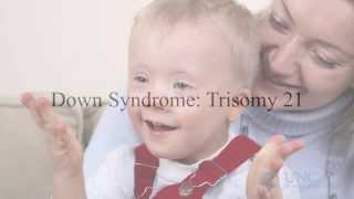 Down Syndrome Trisomy 21 Screening [upl. by Airamzul]