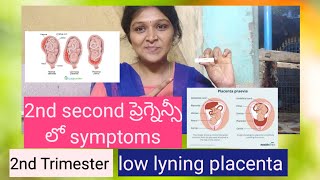 Low lyning placenta  placenta previa 2nd trimester in pregnancy viralvideo trending vlogs [upl. by Analiese]