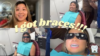 Getting braces vlog [upl. by Brannon]