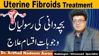 Uterine Fibroids CausesTypesSymptoms And Treatment [upl. by Thaine632]