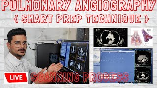 Pulmonary Angiography smart prep technique Live CT Scan  pulmonary angio scanning process [upl. by Enelad]