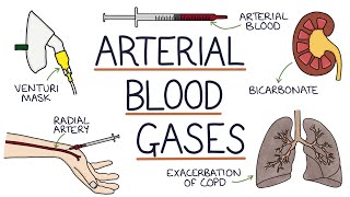 Understanding Arterial Blood Gases [upl. by Kcirdde]