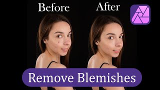 How to Remove Blemishes  Affinity Photo V2 [upl. by Ocana]