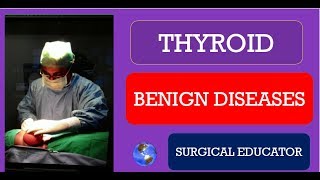 THYROID BENIGN DISEASES How To DIAGNOSE amp TREAT Neck Swellings [upl. by Haram170]