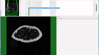 Bruker microCT tutorial Setting the trabecular VOI for the mouse femur [upl. by Sabah]