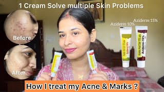 How to use Azelaic Acid correctly  Honest Review  All in One Cream [upl. by Sydelle]