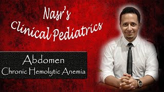 🌟New  عملي الأطفال  Clinical Pediatrics 9  Abdomen amp Chronic Hemolytic Anemia [upl. by Pogue289]