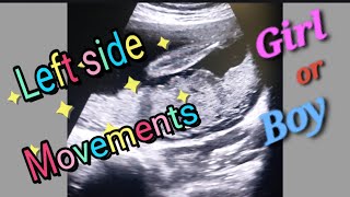 Posterior Placenta With Fetal Heartbeat 130bpm  Left side Baby Movement  27Weeks Baby Genderreveal [upl. by Bauske]